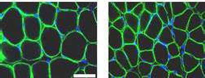 À gauche : cellules musculaires de souris sauvagesÀ droite : cellules musculaires de souris chez lesquelles le gène S6K1 a été inhibé(crédit : INSERM)