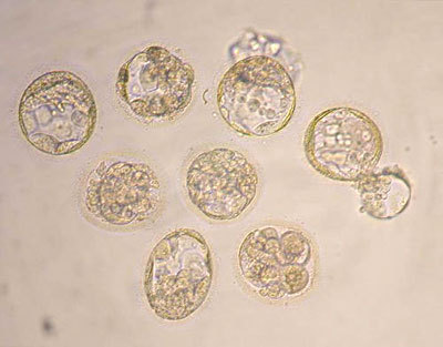 Ces embryons humains, âgés d'une semaine, sont des blastocytes. Leurs cellules semblent toutes identiques, et se transformeront plus tard en cellules de peau, de muscles, de foie, etc. Ces cellules souches intéressent beaucoup les chercheurs.