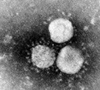 Images en microscopie électronique d'un coronavirus.