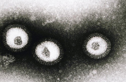 Images du virus de la grippe en culture dans un laboratoire.