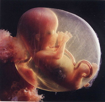 Foetus de 15 semaines