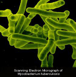 Bactéries Mycobacterium tuberculosis