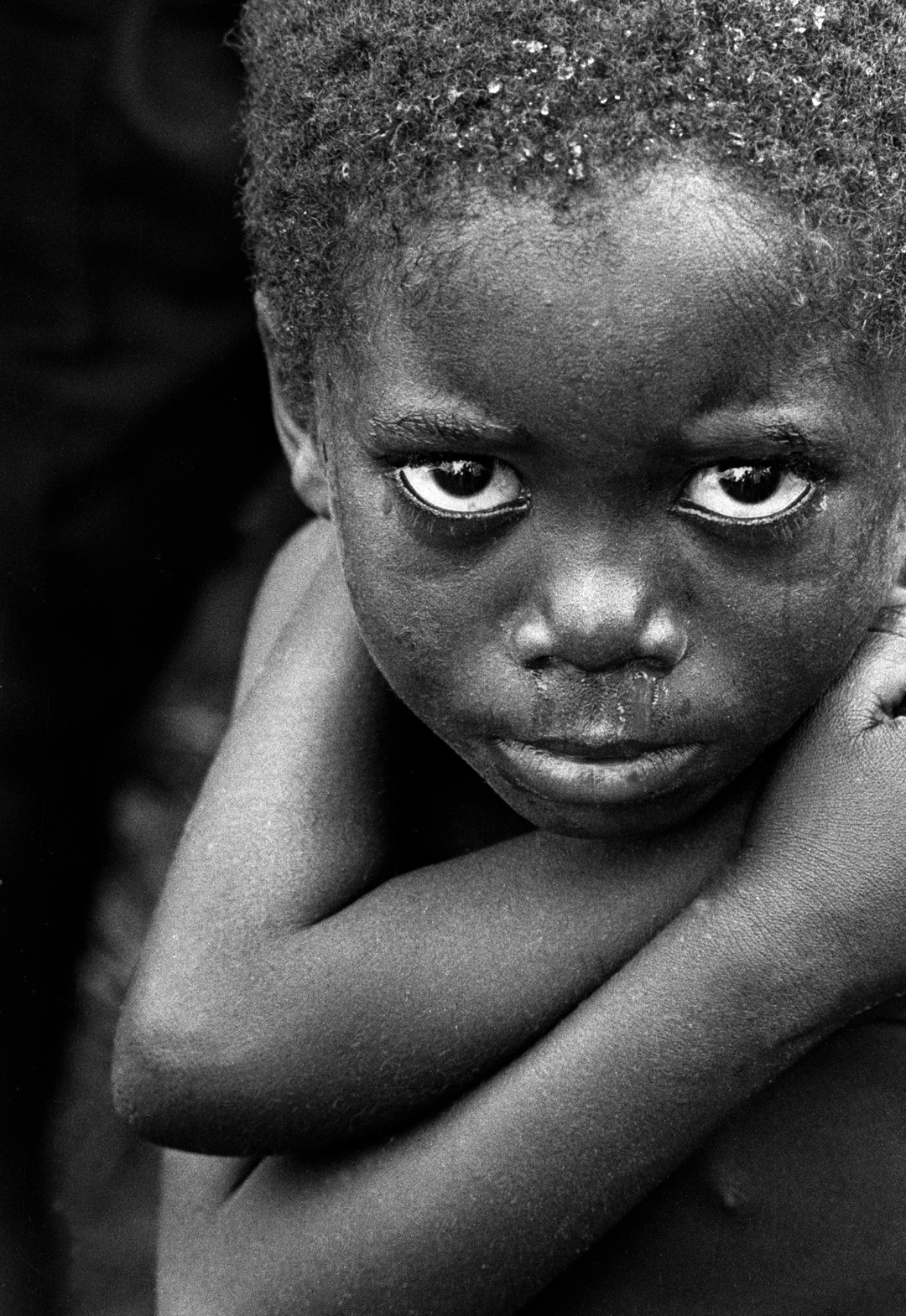 Le paludisme est une maladie qui affecte très majoritairement l'Afrique subsaharienne. Les enfants sont d'ailleurs les principales victimes, lorsqu'ils ne peuvent pas bénéficier de soins. © Daveblume, Fotopédia, cc by nc nd 2.0