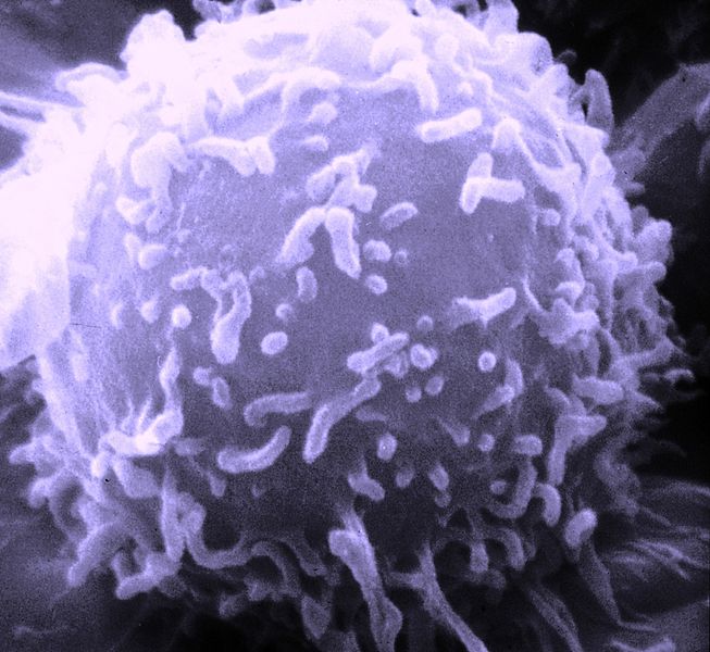 Les lymphocytes NKT sont des cellules très particulières du système immunitaire. Ils doivent leur nom à leur appartenance à la large famille des lymphocytes T (dont on voit ici un représentant au microscope électronique à balayage). En plus des marqueurs des cellules Natural Killer, ils présentent d'autres éléments de l'immunité. Cette spécificité élargit leur spectre d'action et ces cellules interviennent aussi bien dans l'immunité innée que dans l'immunité adaptative. © National Cancer Institute, Wikipédia, DP