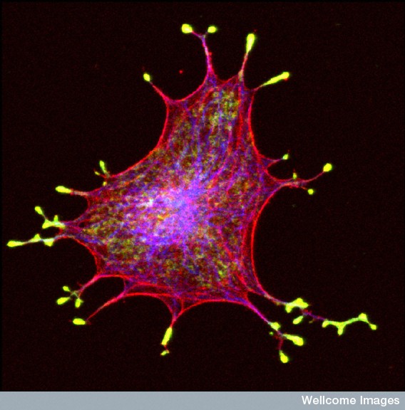 Cette forme étrange est une cellule, plus précisément un mélanocyte. Il produit la mélanine, molécule qui nous protège du soleil en nous faisant bronzer, par l'intermédiaire de mélanosomes (colorés en jaune). © Alistair Hume, Wellcome Images, Flickr, cc by nc nd 2.0