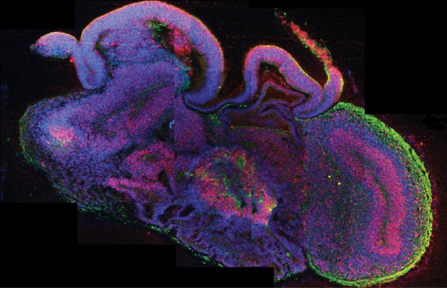 Cette coupe transversale d'un des minicerveaux révèle la nature complexe de la structure. Des neurones (en vert) sont bien mélangés à des cellules progénitrices (en rouge), preuve que le tissu cérébral créé in vitro est bien composite, à l'instar d'un organe entier.&nbsp;© Madeline Lancaster et al., Nature