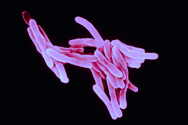 La bactérie Mycobacterium tuberculosis a&nbsp;fondamentalement besoin de l'acide aspartique environnant&nbsp;pour en récupérer l'azote. Et si on l'en empêchait ?&nbsp;© Sanofi Pasteur, Flickr, cc by nc nd 2.0
