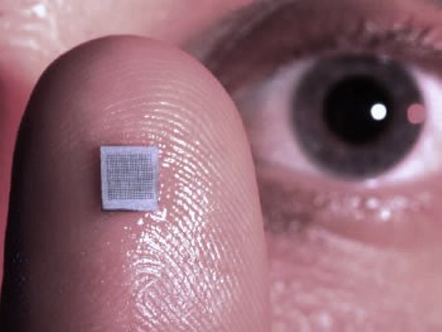 Un patch avec seulement 400 micro-aiguilles. Les nano-patches emploient des aiguilles plus petites et plus densément groupées. Crédit : Stanley Leary-Georgia Tech Research