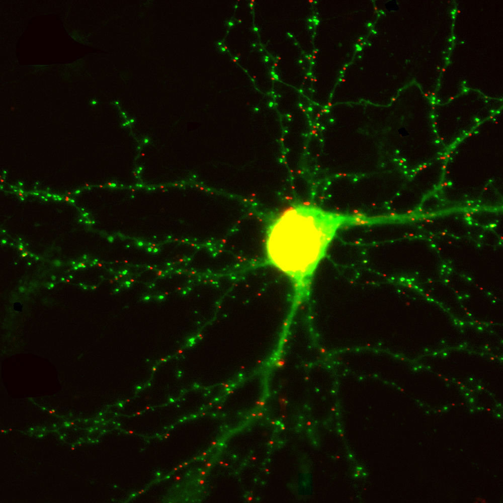 Un neurone en culture. Les synapses excitatrices et inhibitrices sont respectivement en vert et en rouge.&nbsp;© Don Arnold, DP