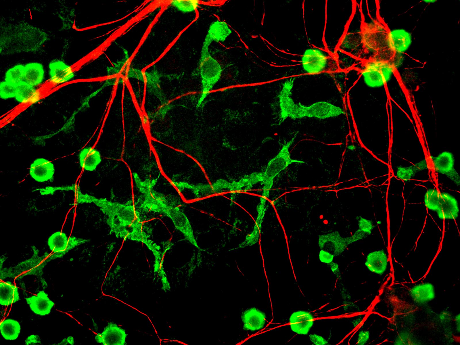 Le nombre de neurones chez une personne&nbsp;est estimé entre 86 et 100 milliards, et il&nbsp;diminue au cours des années.&nbsp;©&nbsp;Journal of Cell Biology, Flickr, cc by nc&nbsp;sa 2.0