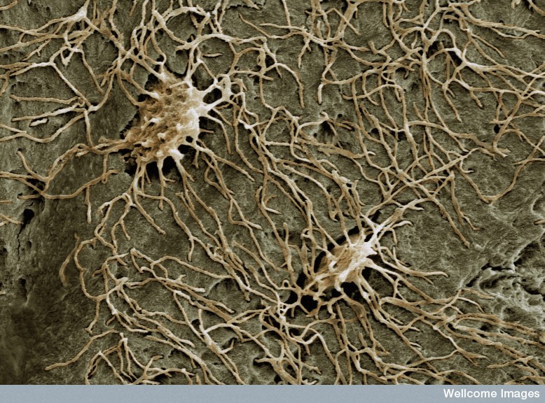 Les ostéocytes, issus des ostéoblastes, sont des cellules qui participent au maintien de la structure osseuse. Ils communiquent entre eux&nbsp;via de longues jonctions cytoplasmiques. Leur rôle est fondamental après une fracture.&nbsp;© Kevin McKenzie, Wellcome Images, Flickr, cc by nc nd 2.0