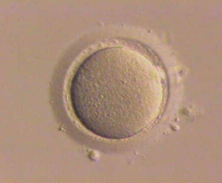 La recherche sur les cellules souches embryonnaires a été autorisée par le Sénat. © DR