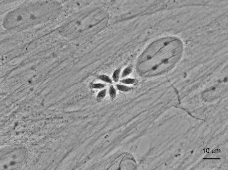 Image microscopique d’une cellule humaine infectée par Toxoplasma gondii avec la formation d’une rosette de 8 parasites. Crédit CNRS/Inserm