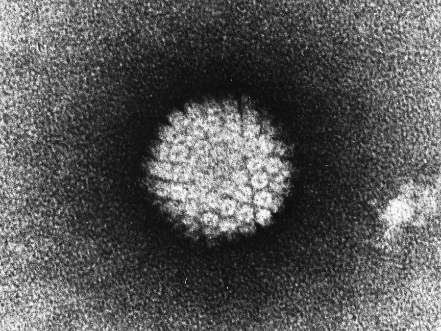 Le papillomavirus existe sous de multiples formes. Les variants numérotés 16 et 18 sont parmi les plus dangereux et induisent des cancers du col de l'utérus et de la gorge.&nbsp;© NIH, Wikipédia, DP