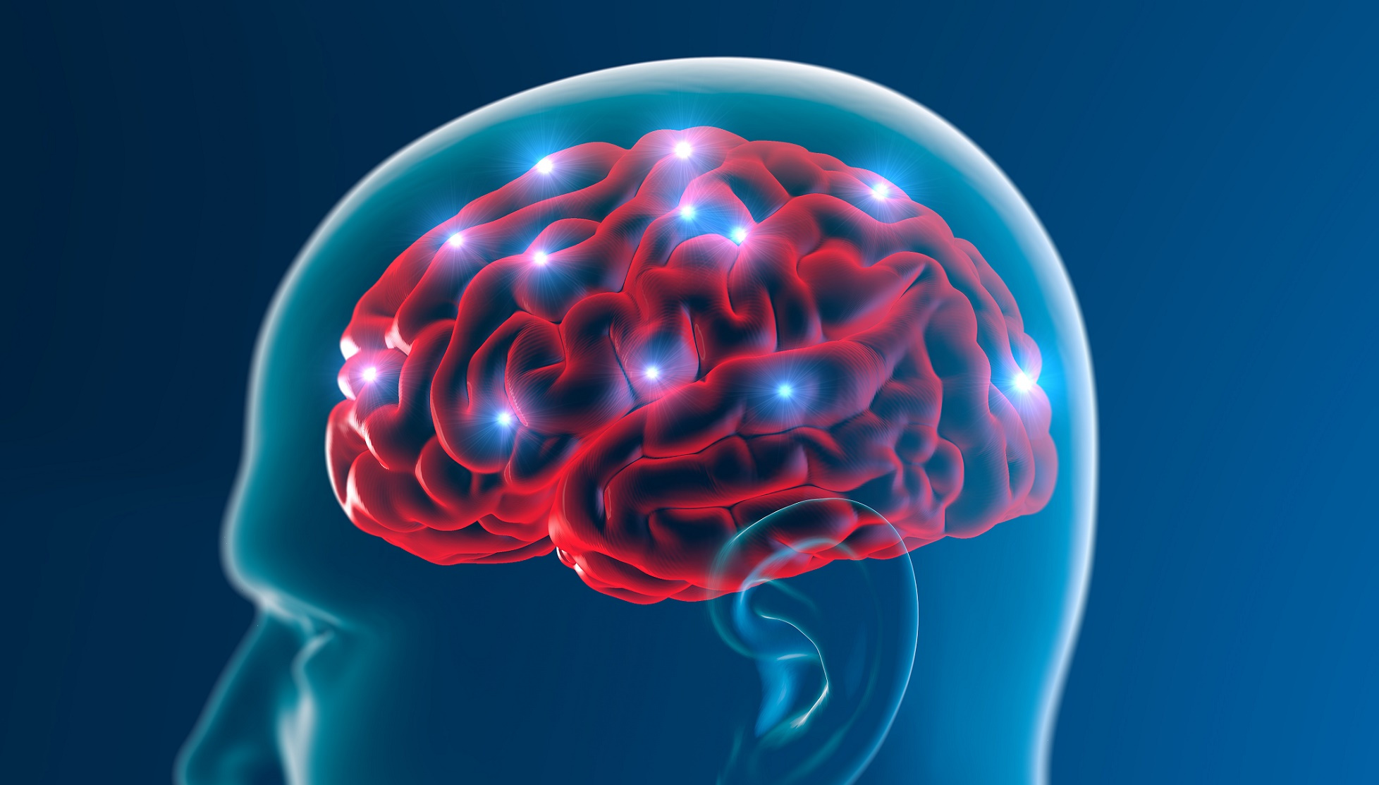 La maladie d’Alzheimer se caractérise à la fois par des plaques amyloïdes et l’accumulation de protéines Tau dans le cerveau. © Naeblys, Shutterstock