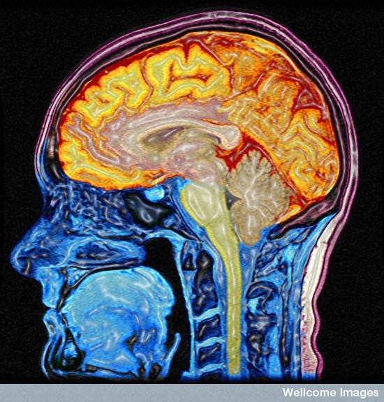 Le cerveau humain, ici vu sous IRM, recèle encore de nombreux mystères. Dans une étude, les scientifiques ont réussi à identifier une émotion à partir d'une image cérébrale.&nbsp;© Mark Lythgoe, Chloe Hutton, Wellcome Images, Flickr, cc by nc nd 2.0