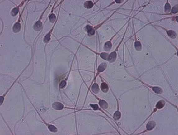 Spermatozoïdes colorés au papanicolaou (colorant cytologique pentachrome). © CPMA