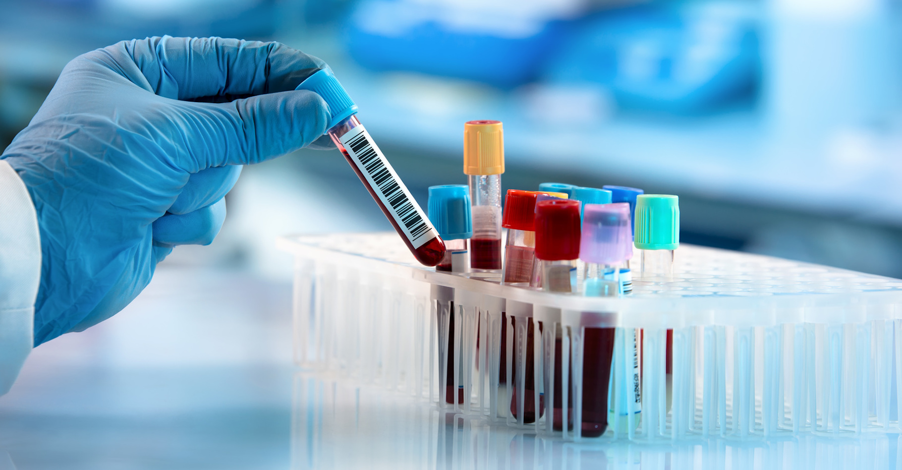 Les tests pharmacogénomiques utilisent des informations génétiques, généralement obtenues à partir d'un prélèvement de joue, d'un test sanguin ou d'un échantillon de salive, pour guider le choix et le dosage des médicaments. © angellodeco, Fotolia