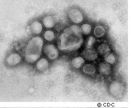 Un troupeau de virus H1N1 au microscope électronique. © CDC
