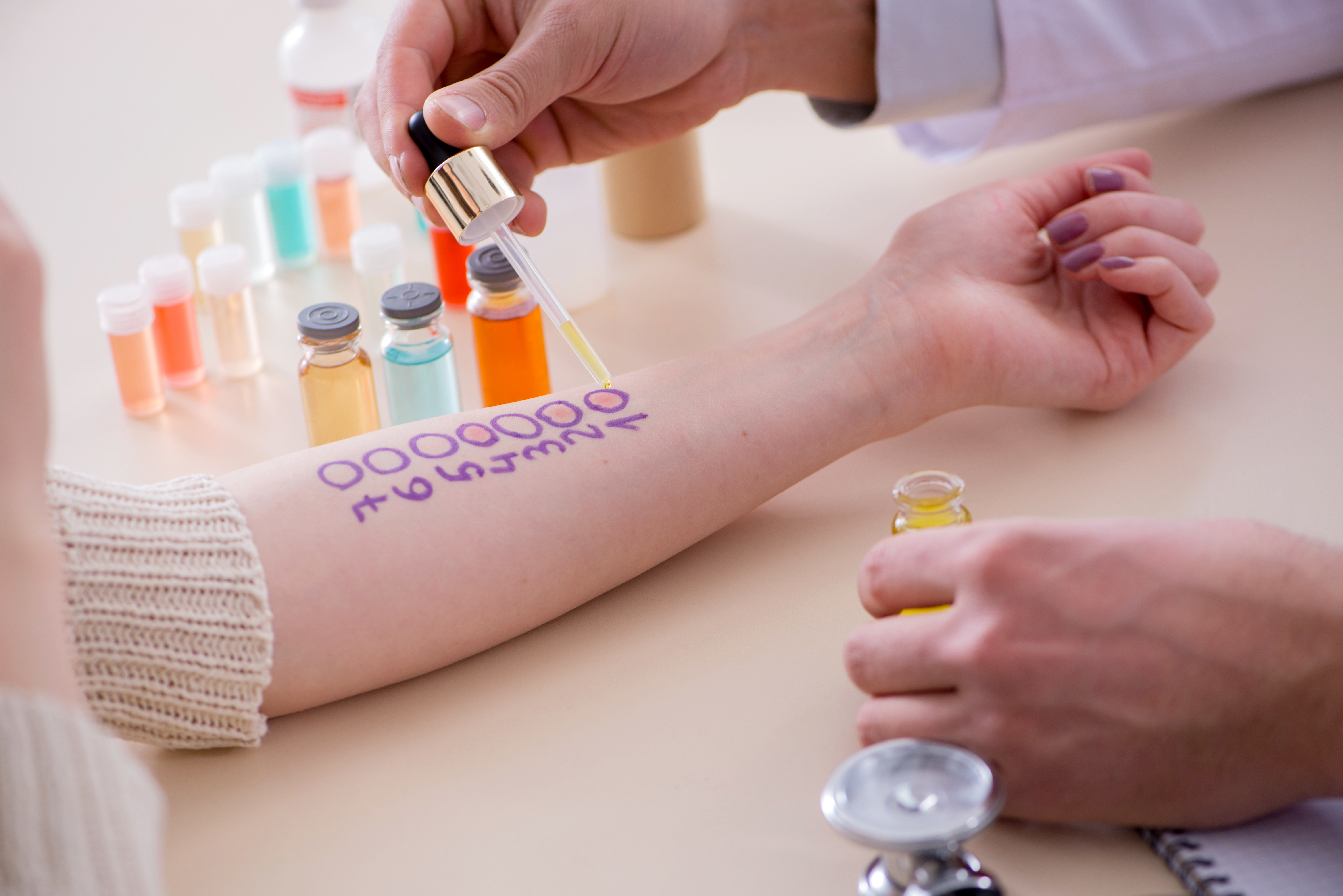 L’allergologue procède à des tests cutanés afin de déterminer les allergies de son patient. © Elnur, Adobe Stock.