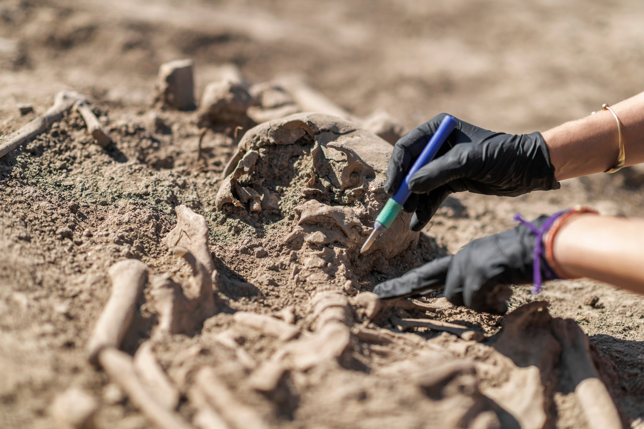 Une découverte archéologique extraordinaire a été faite à Freising, en Allemagne, mettant au jour un squelette médiéval équipé d'une prothèse de main en fer. © Microgen, Adobe Stock