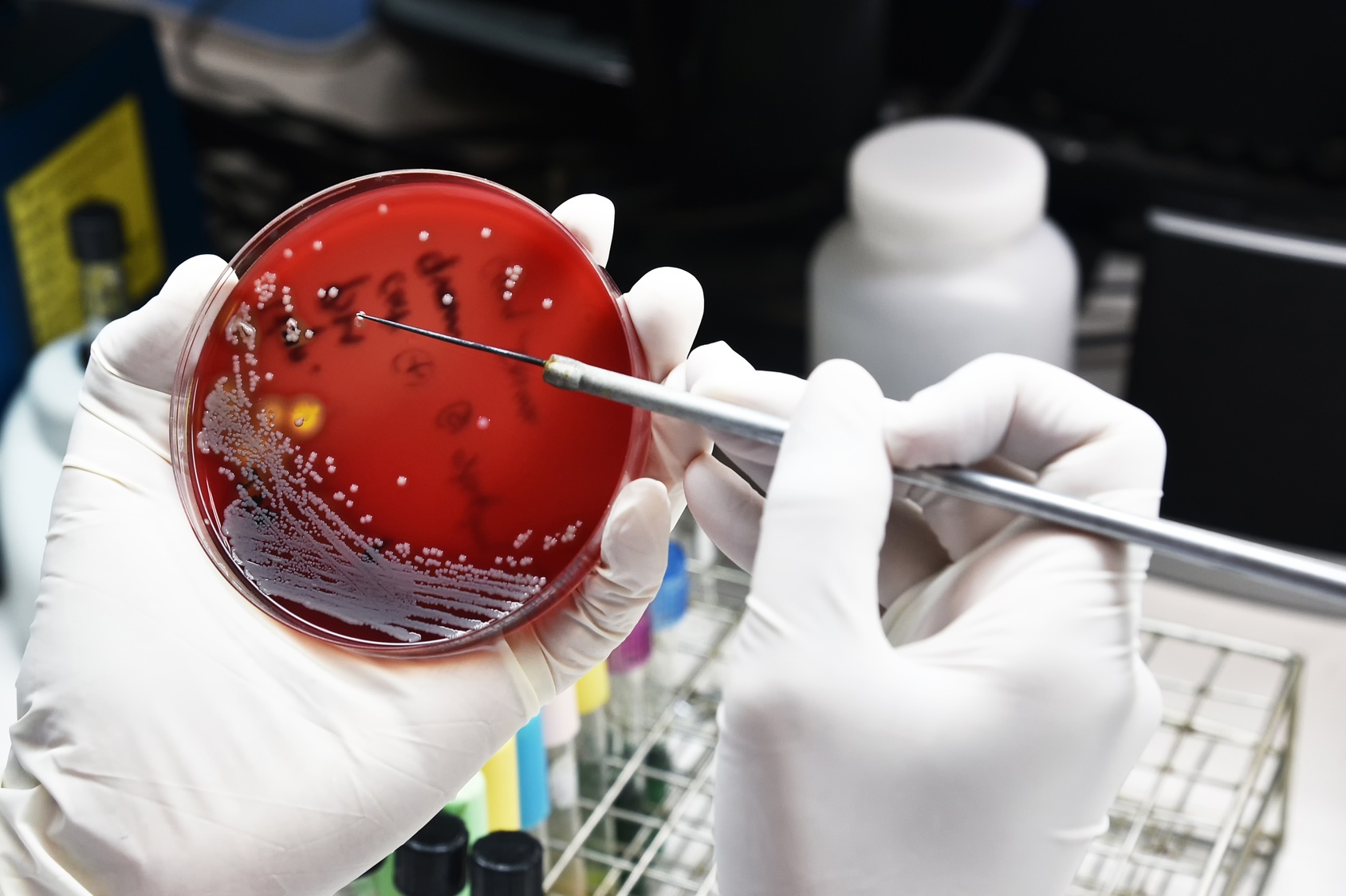 Les chercheurs ont trouvé une classe d’enzymes bactériennes qui représentent un espoir pour imaginer de nouveaux antibiotiques. © analysis121980, Fotolia