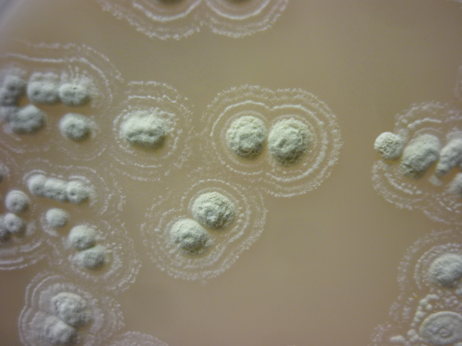 La nouvelle espèce de bactérie Streptomyces myrophorea a été découverte dans le sol d'Irlande du Nord. Elle inhibe la croissance de quatre des six superbactéries les plus préoccupantes et pourrait donc un jour être la source d'un ou de plusieurs nouveaux antibiotiques. © Gerry Quinn, Swansea University