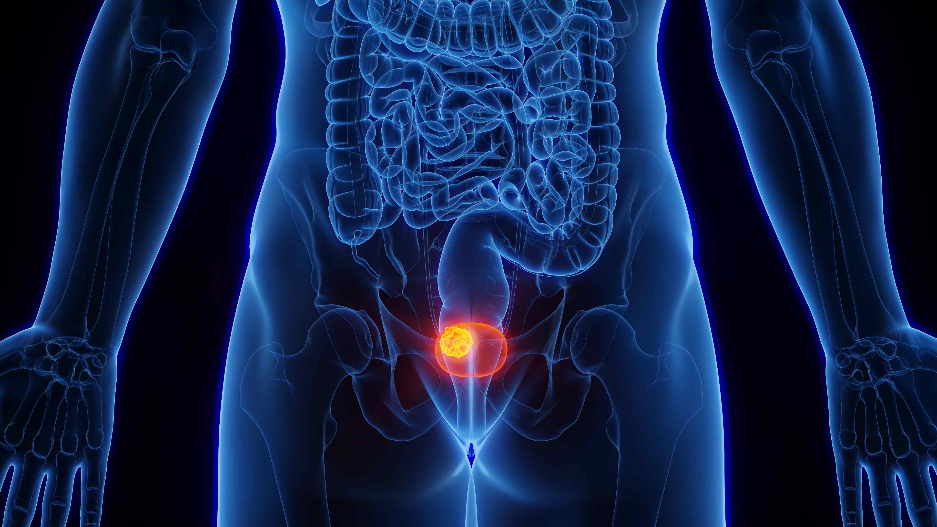 Le cancer de la vessie touche principalement les hommes. © Sebastian Kaulitzki, Adobe stock