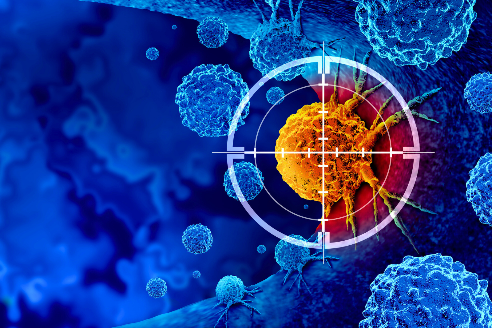 Ces dix cancers défient encore la médecine moderne : ce que vous devez savoir pour vous en prémunir. © Wildpixel, iStock