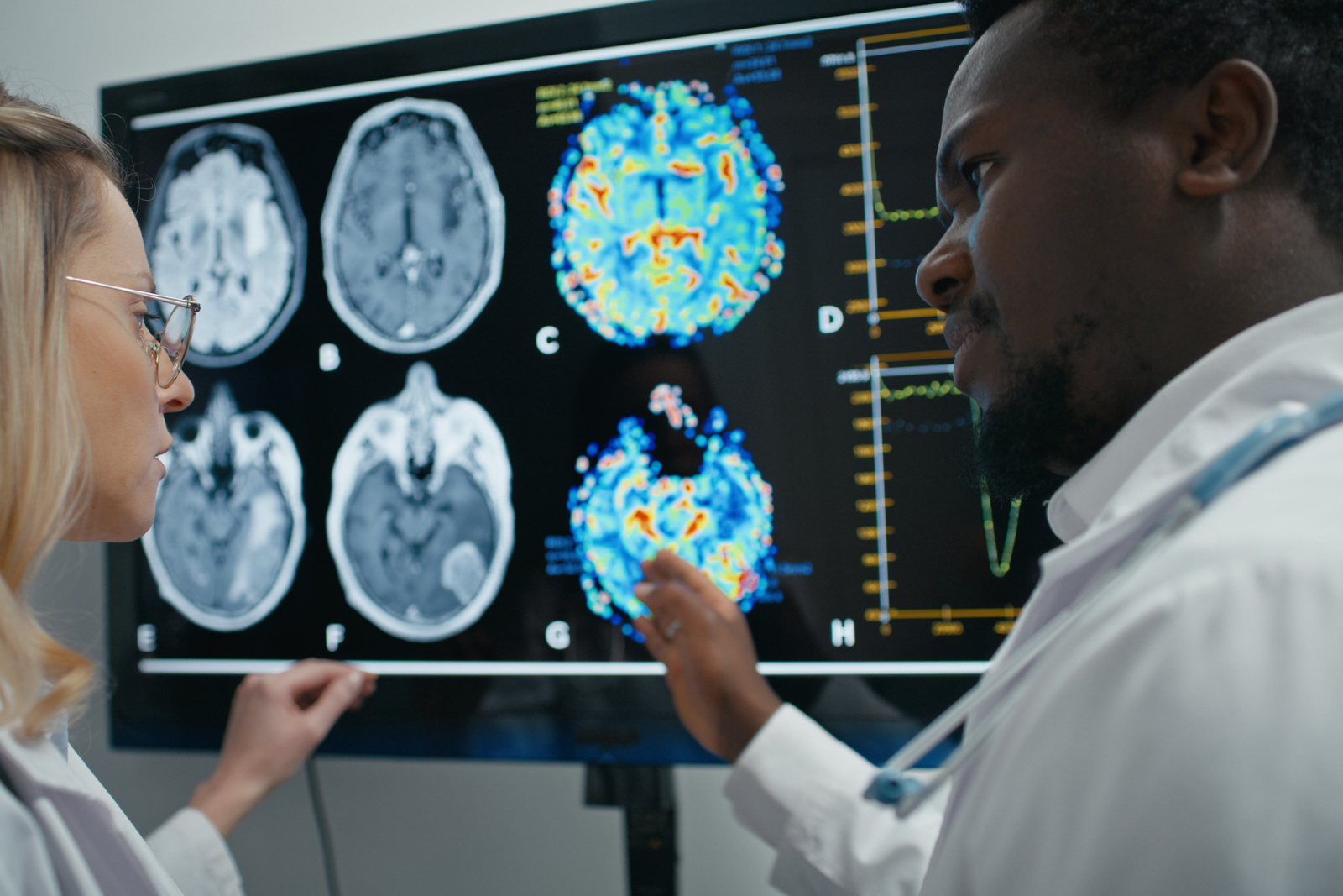 Un cerveau d'humain adulte crée encore de nouveaux neurones. © Janiecbros, iStock