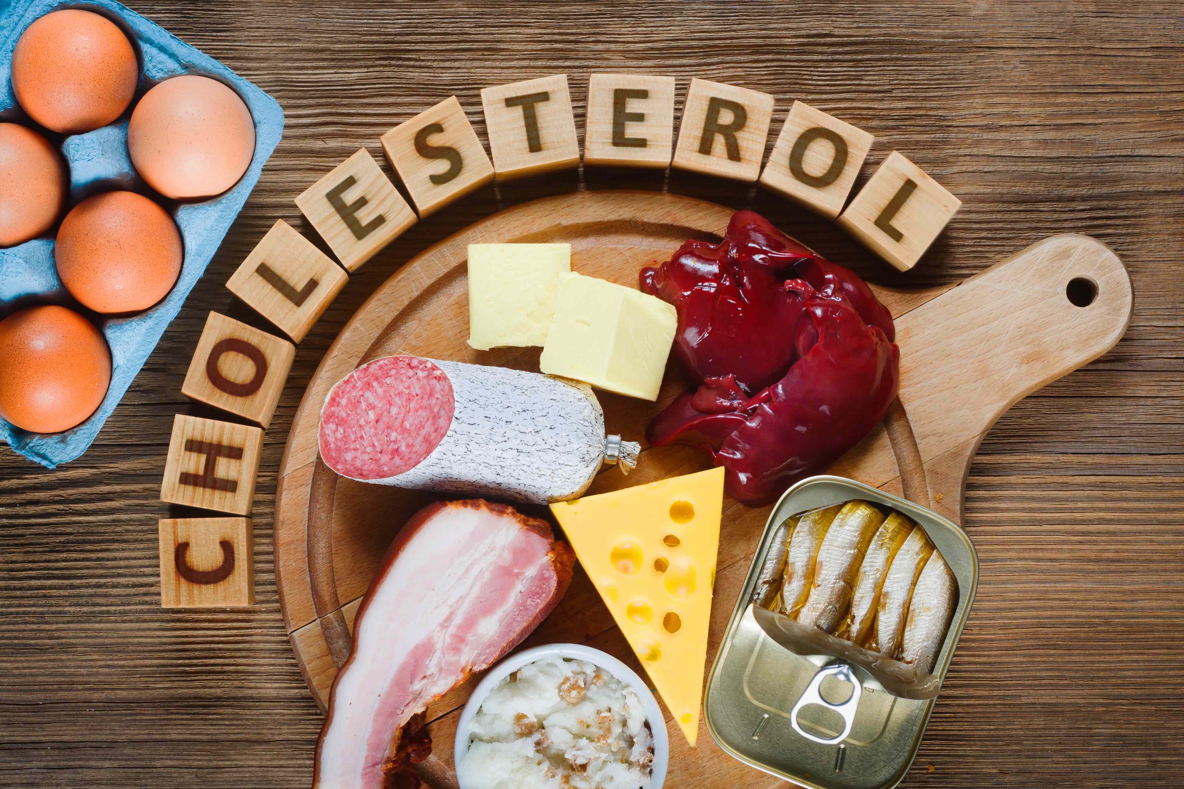 Les aliments riches en graisses saturées sont à limiter pour faire baisser le taux de cholestérol. © airborne77, Adobe Stock