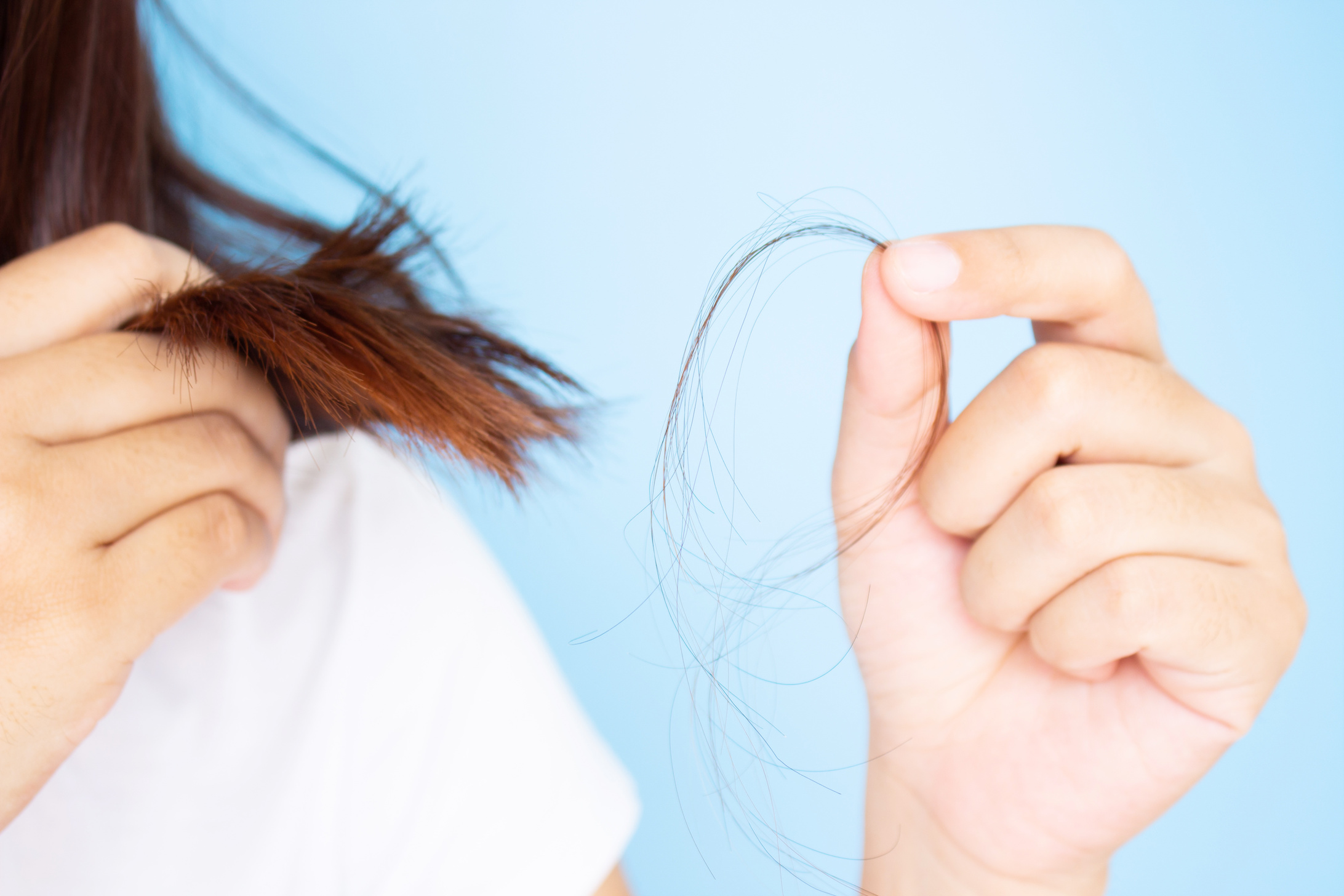 Des solutions existent pour freiner la chute des cheveux. © Pangpleiades, Adobe Stock