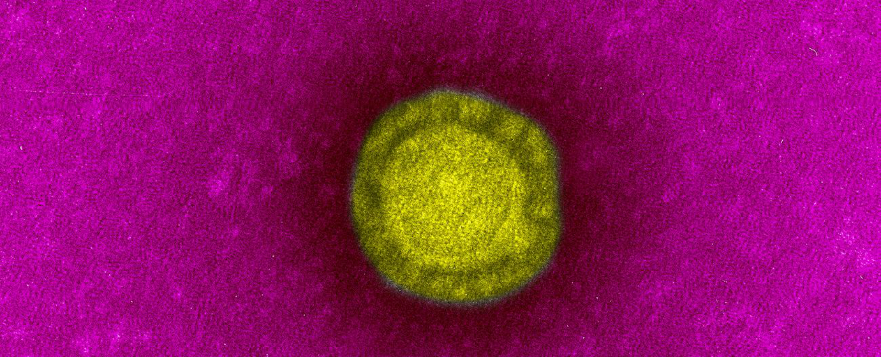 Un coronavirus, agent du syndrome respiratoire aiguë sévère ou Sras. © Institut Pasteur