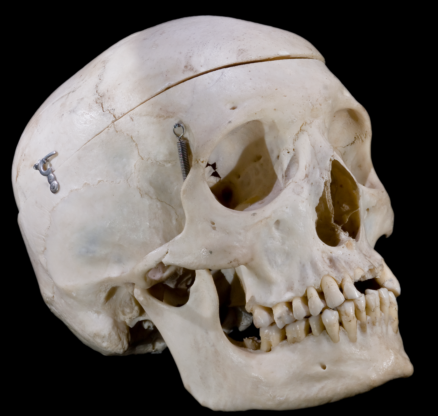 Le splanchnocrâne est une partie du squelette céphalique. © Didier Descouens, Wikimedia Commons, CC by-sa 4.0