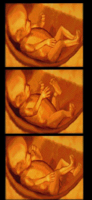 Le fœtus et la marche