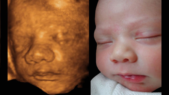 Visage du fœtus et du nouveau-né