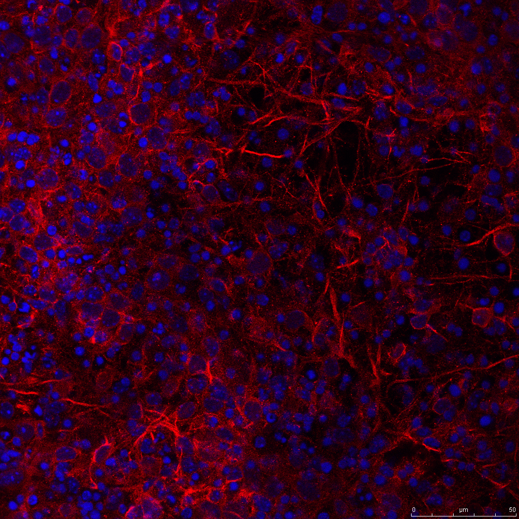 Réseau de neurones et leurs noyaux