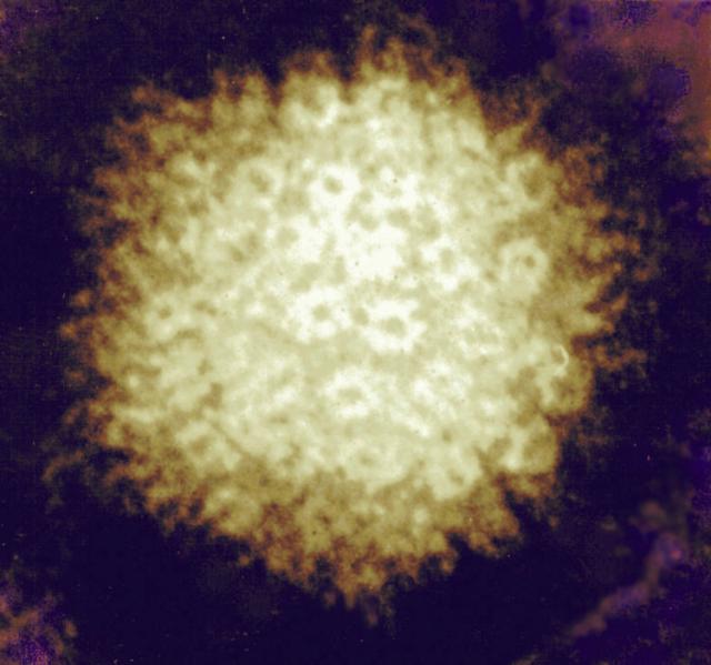 Le virus varicelle zona (VZV) est, comme son nom l'indique, responsable de la varicelle et du zona. Une fois la varicelle passée, il peut se cacher dans les ganglions et réapparaître plus tard sous la forme de zona. Selon cette étude, il pourrait augmenter le risque d’accidents vasculaires. © NIAID, Flickr, cc by 2.0