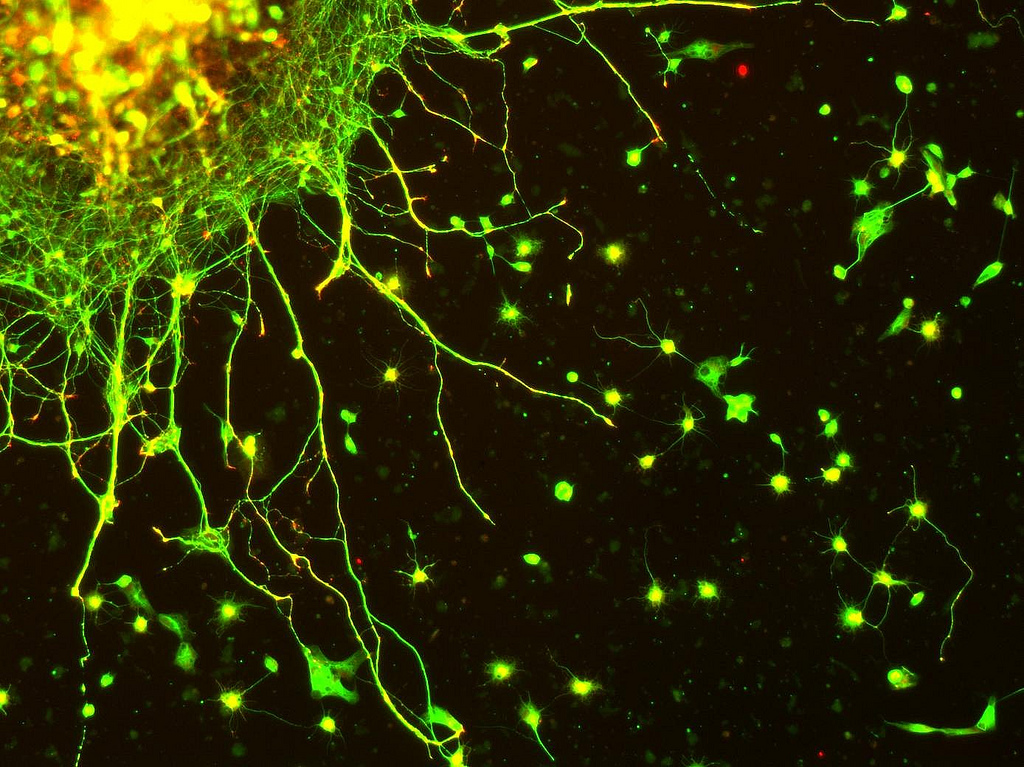 Les dendrites sont des prolongements cytoplasmiques qui entourent le corps cellulaire des neurones. Cette étude met en évidence leur rôle primordial, jusqu’ici insoupçonné, dans le traitement des informations nerveuses. © thelunch_box, Flickr, cc by nc 2.0