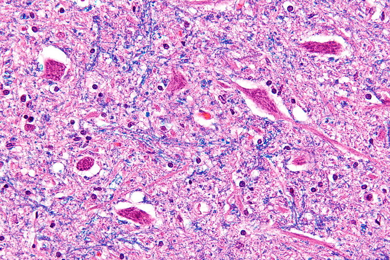 Des motoneurones en microscopie optique. La maladie de Charcot est une affection qui dégrade ces neurones. © Nephron, Wikimedia Commons, cc by sa 3.0