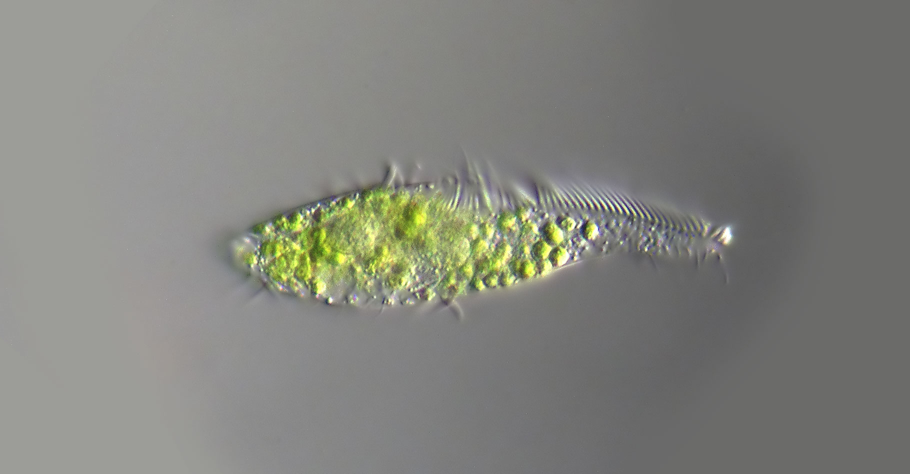 Vidéo : les protistes, êtres unicellulaires