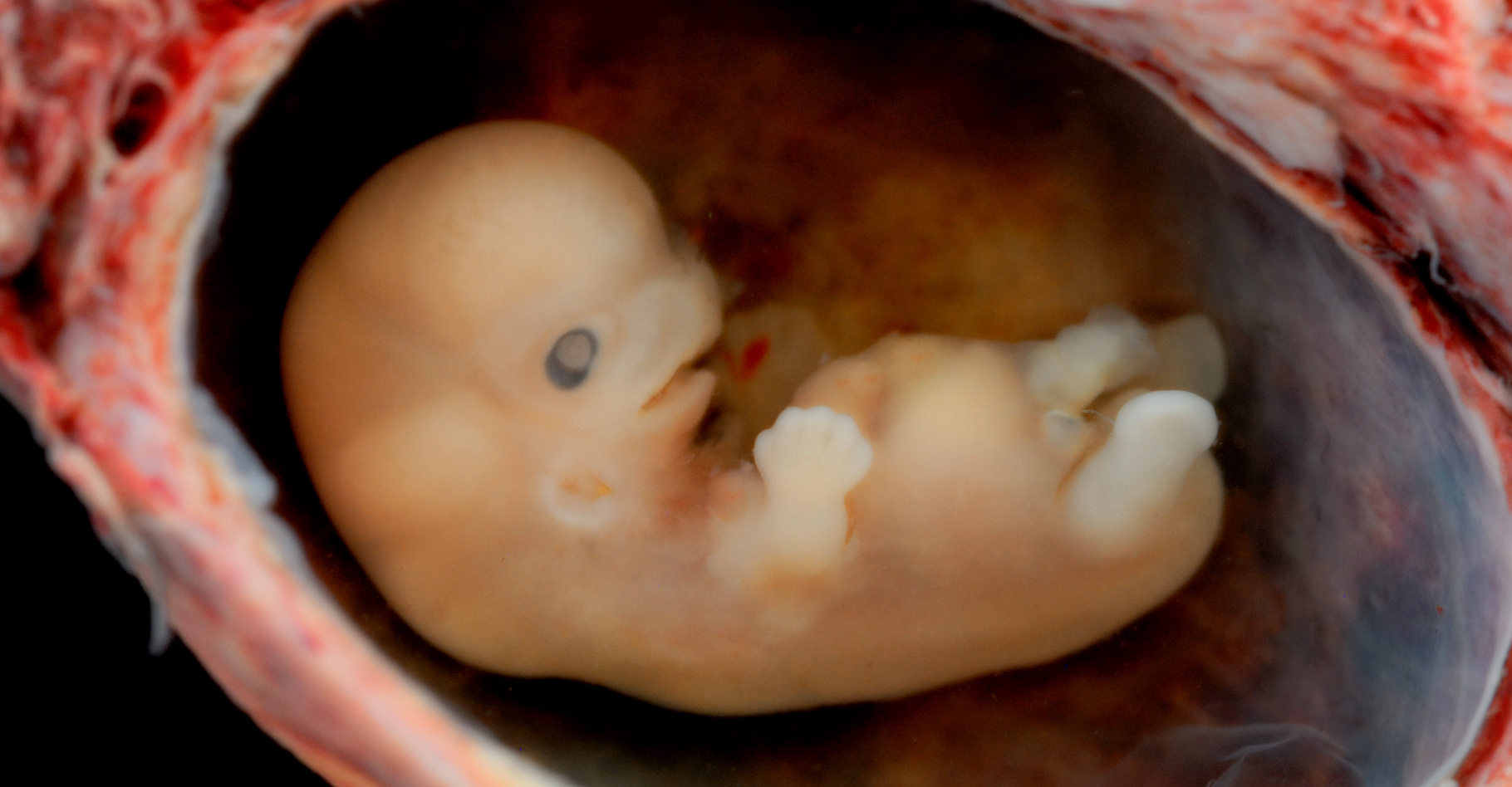 Embryon humain d'environ six semaines. © Lunas Caustic - CC BY-NC 2.0