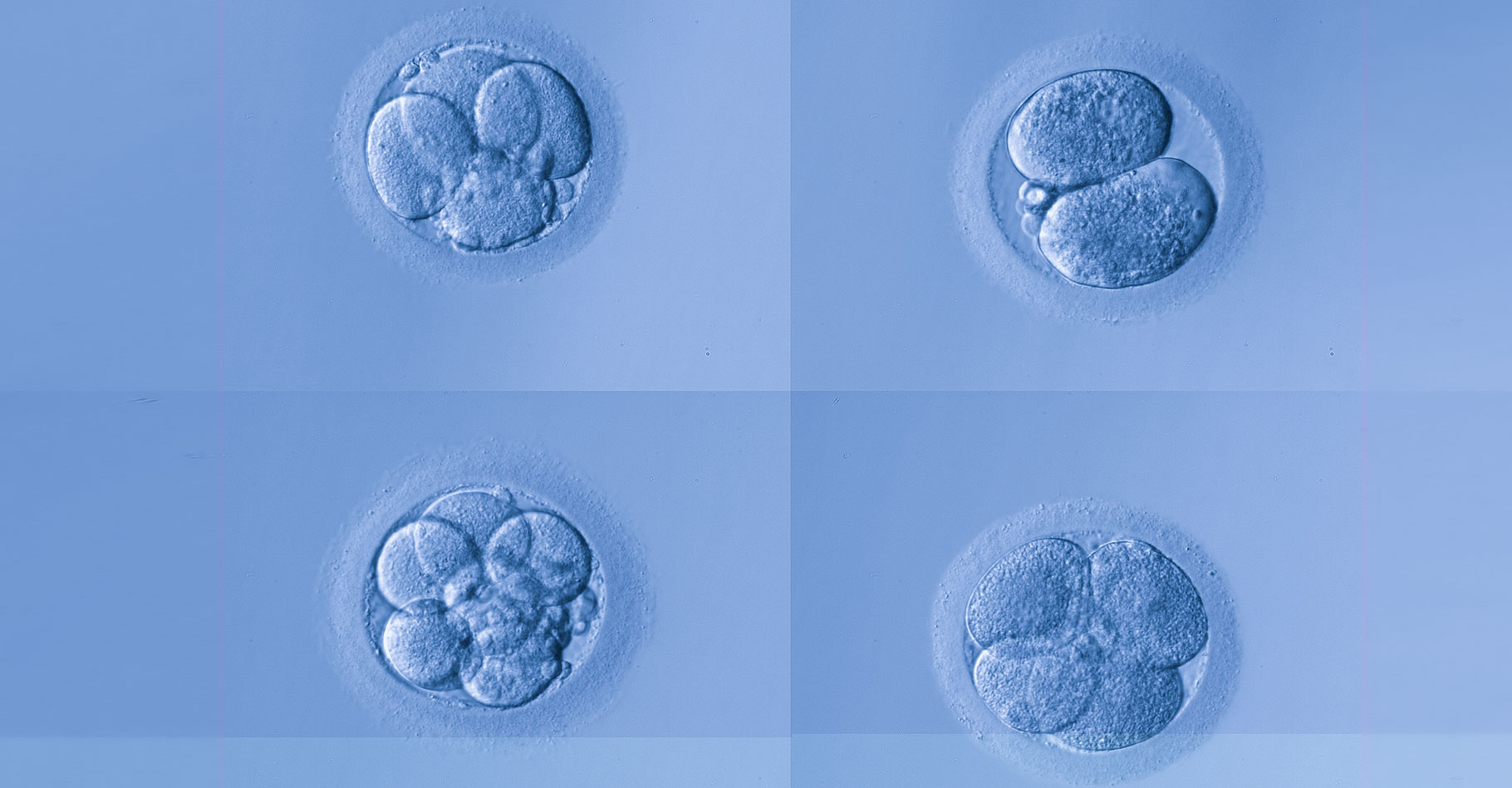 Enceinte de 1 mois : l'embryon à 1 mois de grossesse