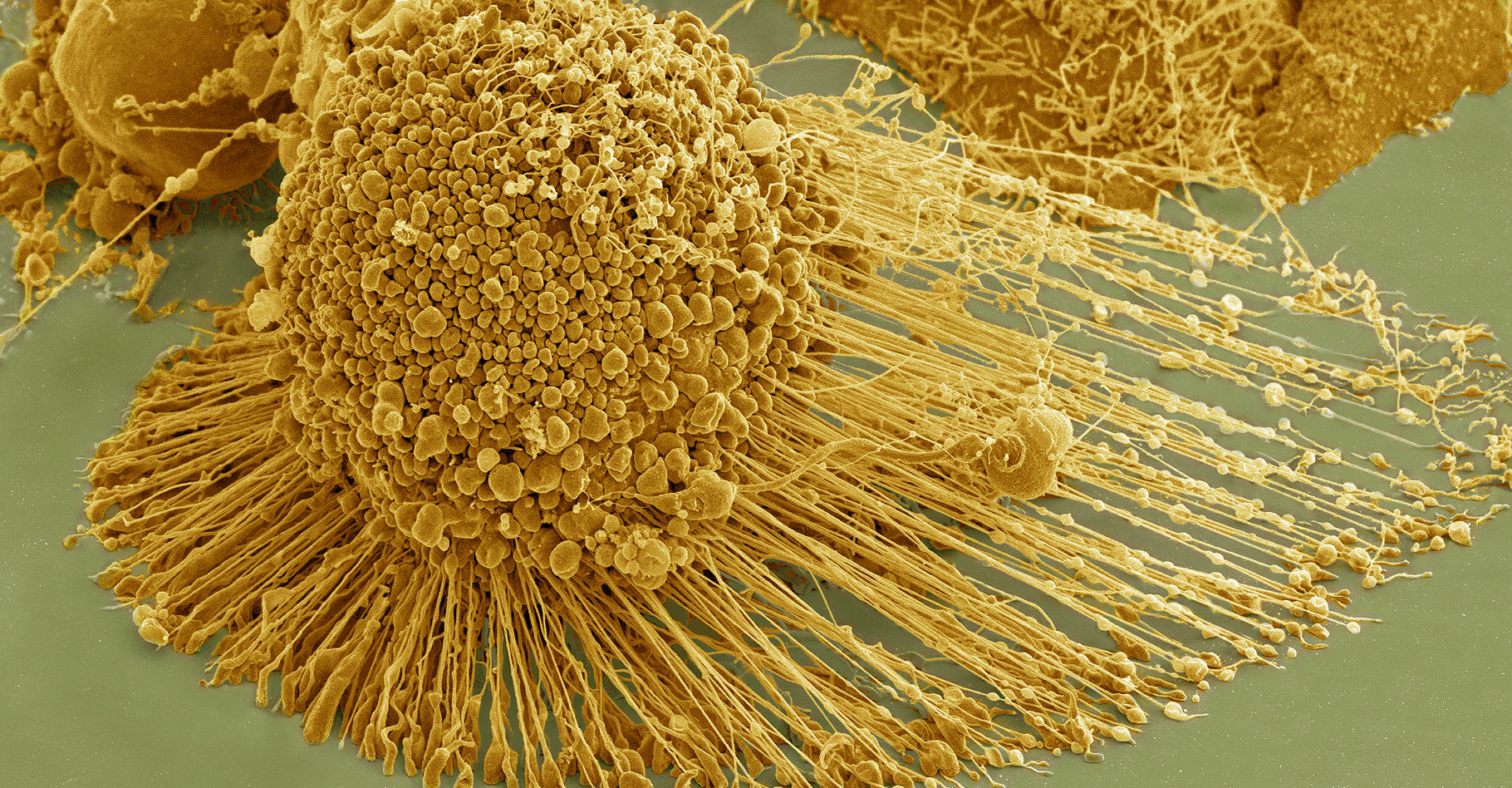Cellules HeLa observées au microscope électronique à balayage.&nbsp;© National Institutes of Health (NIH) - Domaine public