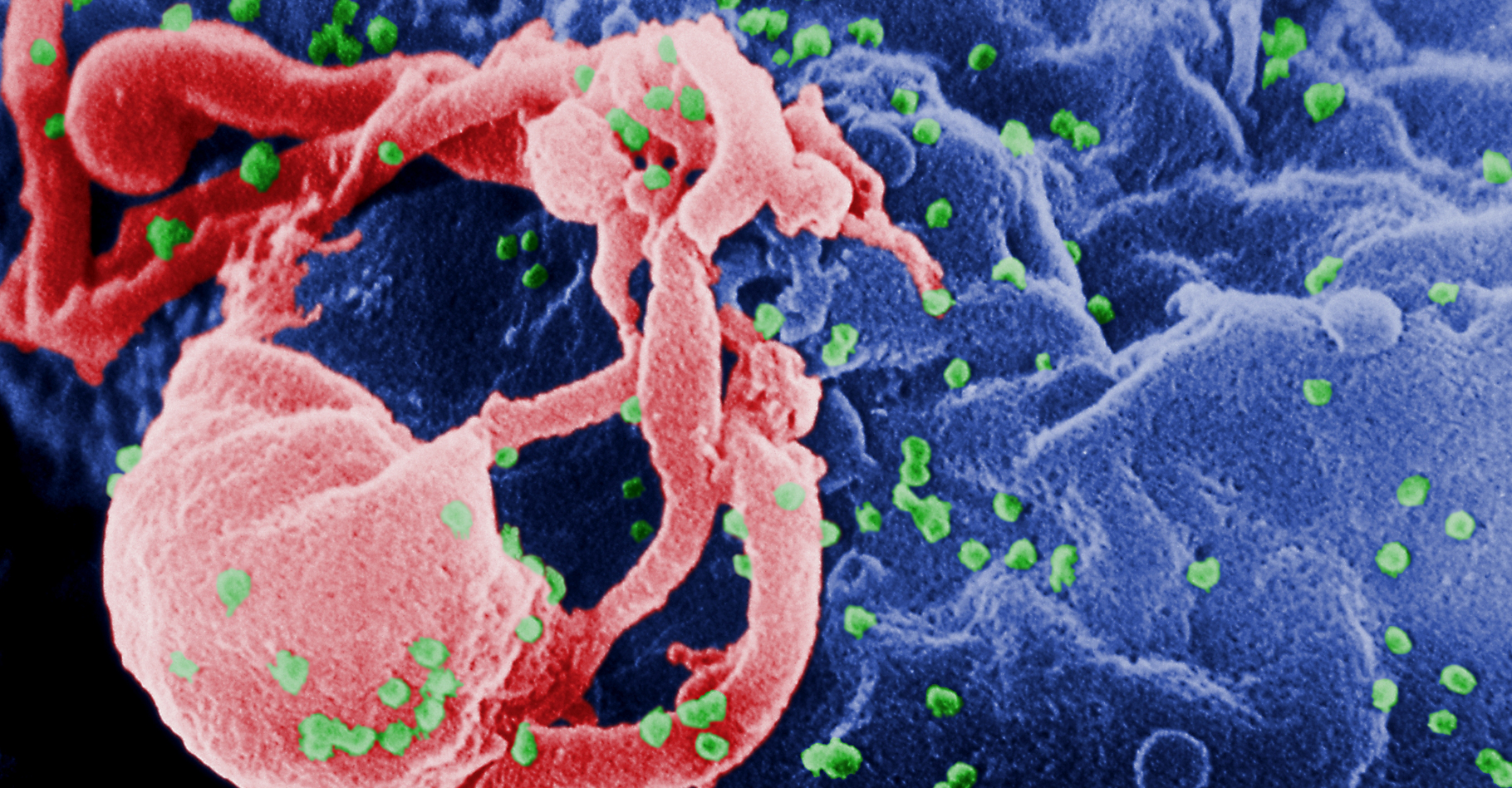 Virus HIV fixé sur un lymphocyte vu en microscopie électronique.&nbsp;© C. Goldsmith - Domaine public
