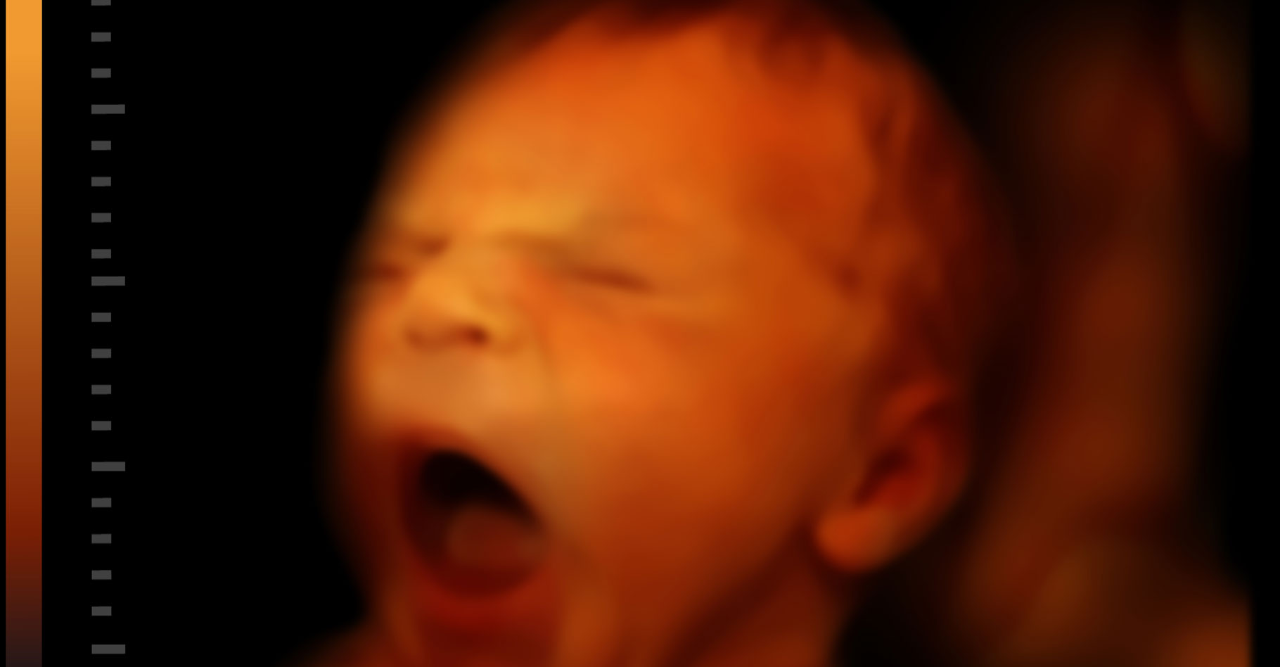Bébé : à quoi ressemblent les bâillements du fœtus ?