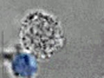 Lymphocyte T et reconnaissance de l'antigène