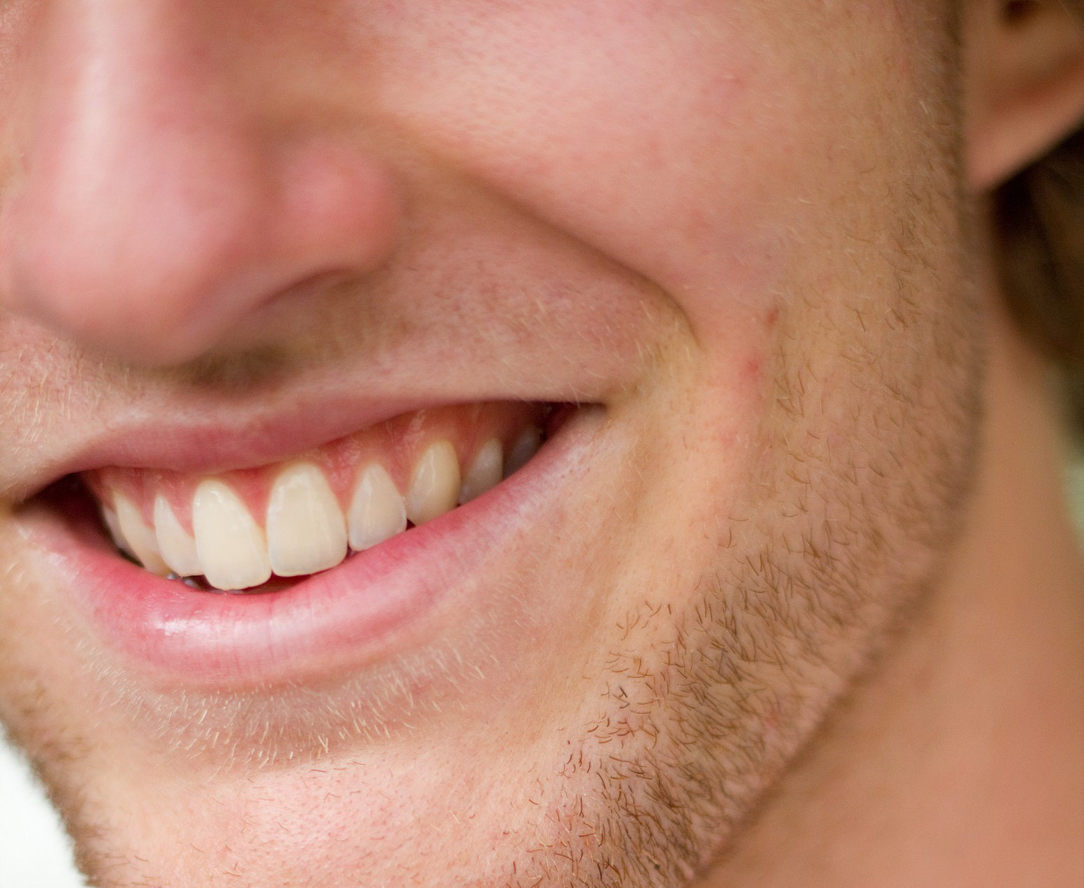 Les muscles zygomatiques se contractent pour sourire. © Tom Newby, Flickr, CC by 2.0