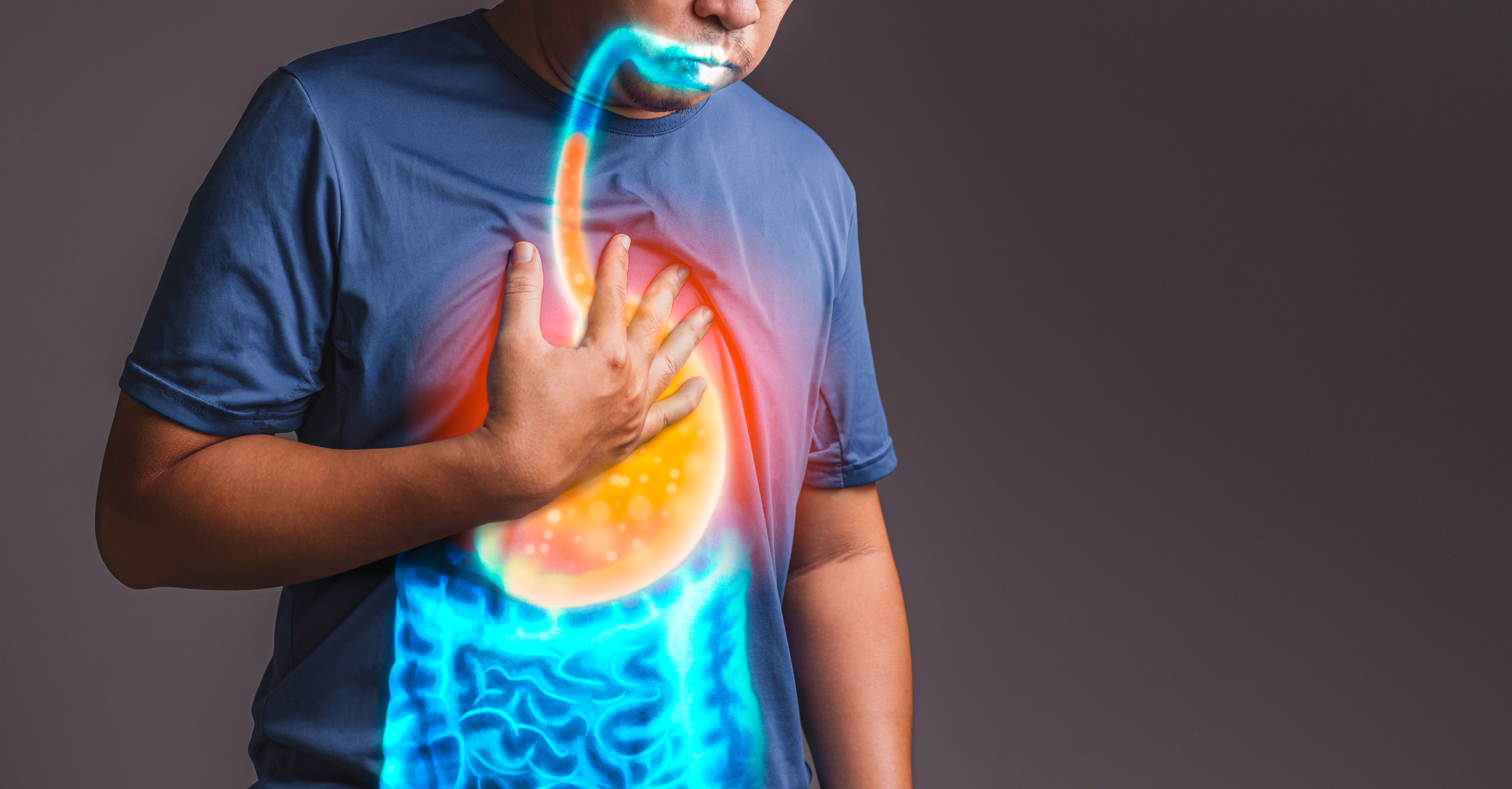 Le reflux&nbsp;gastro-œsophagien est un symptôme de l'œsophagite à éosinophiles. © Suttipun, Adobe Stock