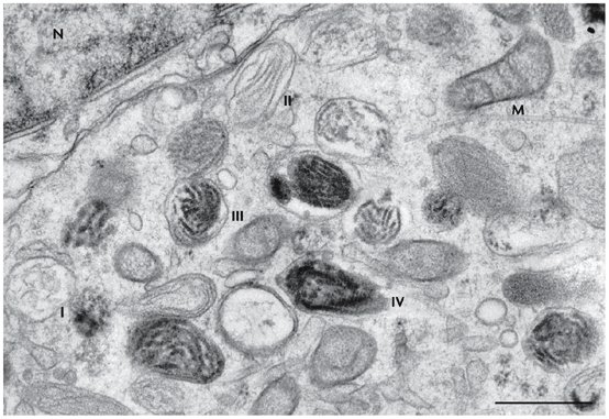 Un mélanocyte humain dans lequel des mélanosomes sont observés à différents stades de leur maturation (numérotés&nbsp;de I à IV). On remarque le noyau de la cellule (N) et une mitochondrie (M). La barre d'échelle représente 0,5 micron.&nbsp;©&nbsp;Graça Raposo &amp; Michael S. Marks/Nature Rewiews/Molecular Cell Biology